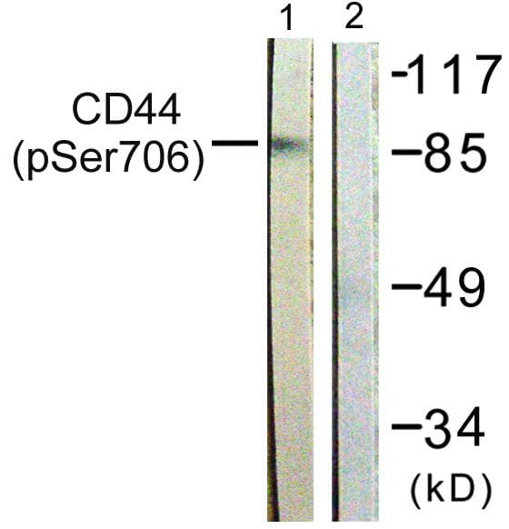 CD44 Antibody (phospho-Ser706)