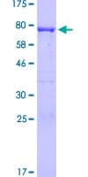 Human MIPOL1 Protein (Recombinant GST)