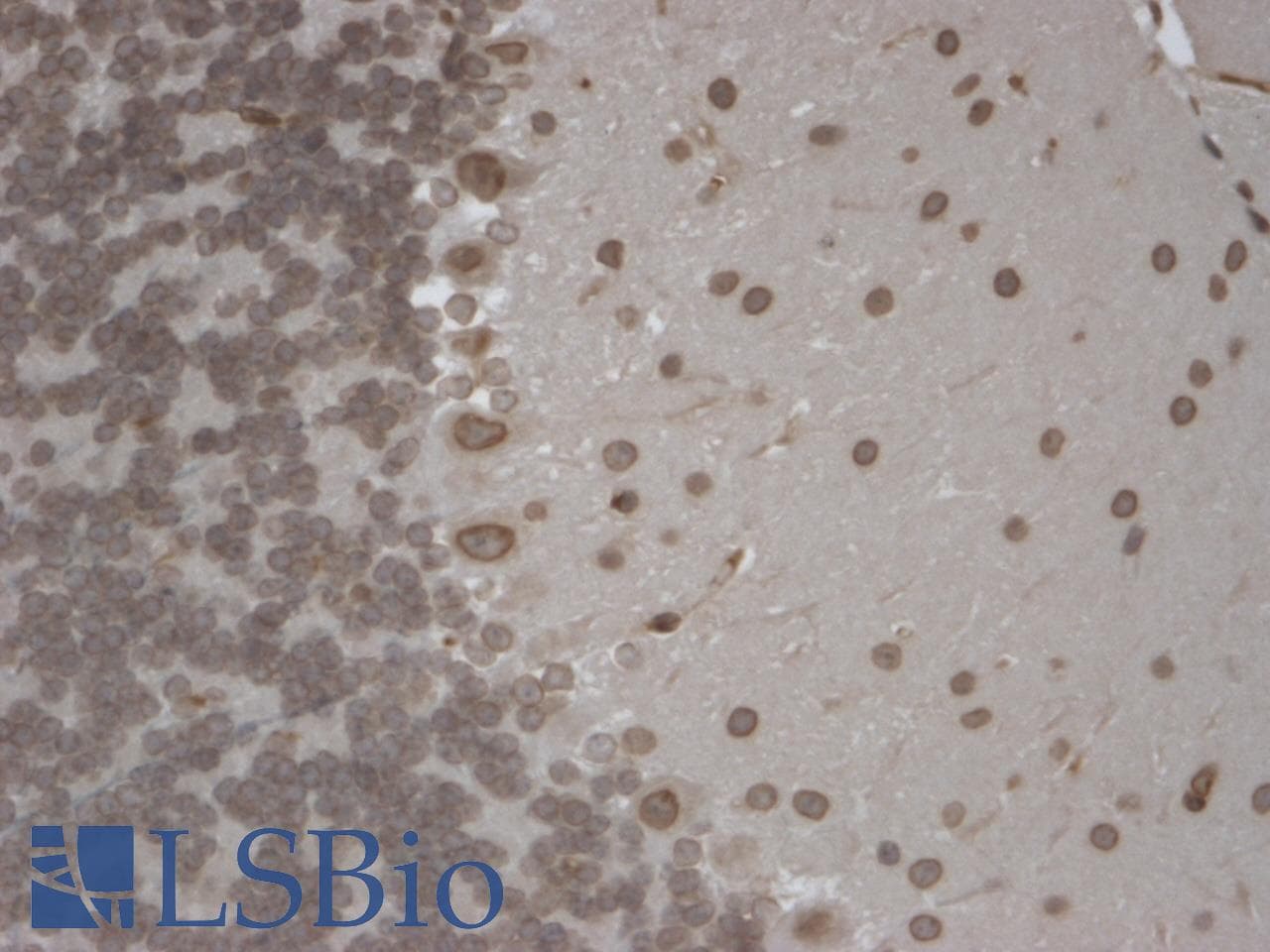 IHC-plus™ TRPM7 Antibody (aa1817-1863, clone S74-25)