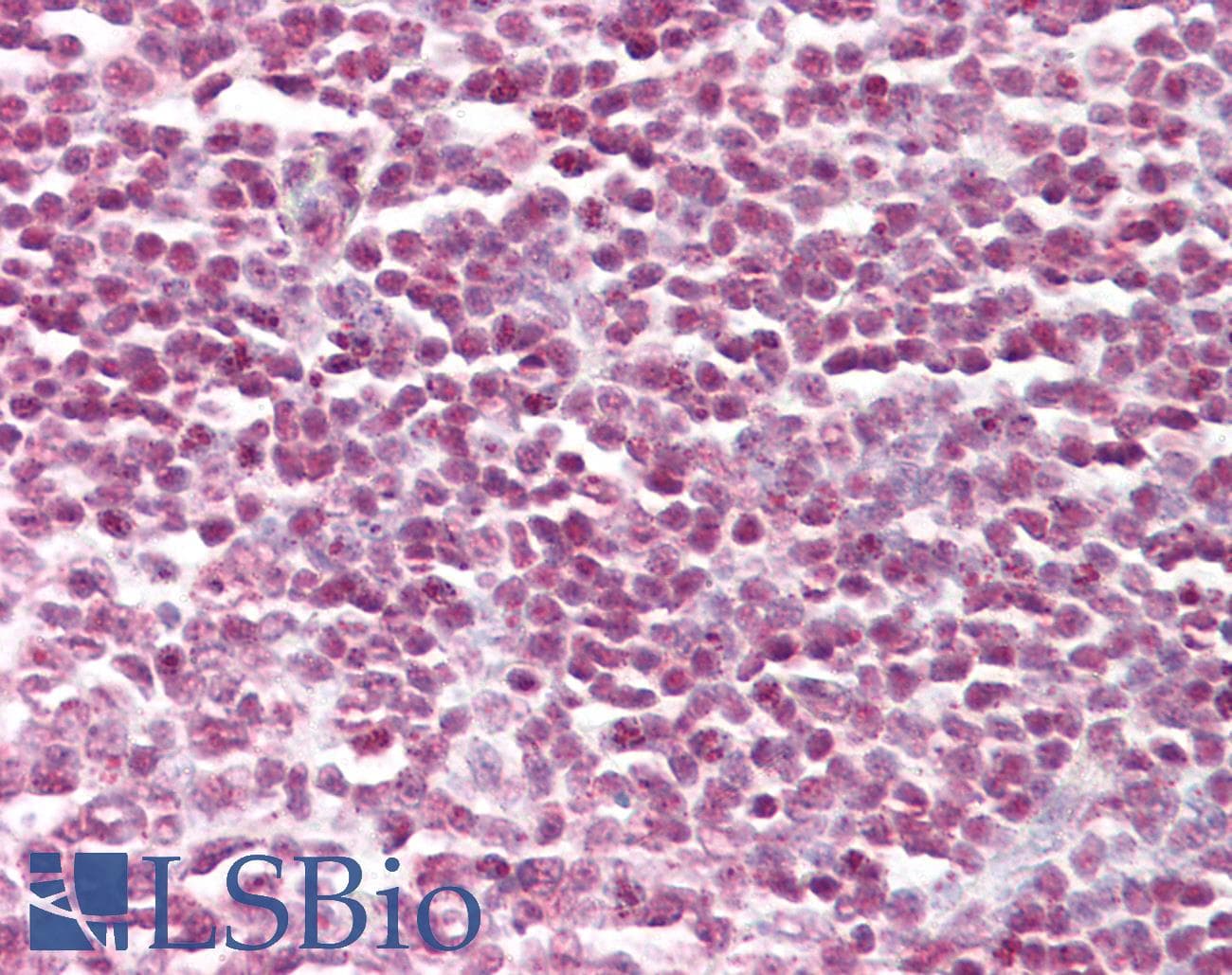 IHC-plus™ STAT5A Antibody (aa745-794)