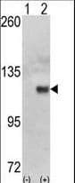 HK1 / Hexokinase 1 Antibody (aa78-108)