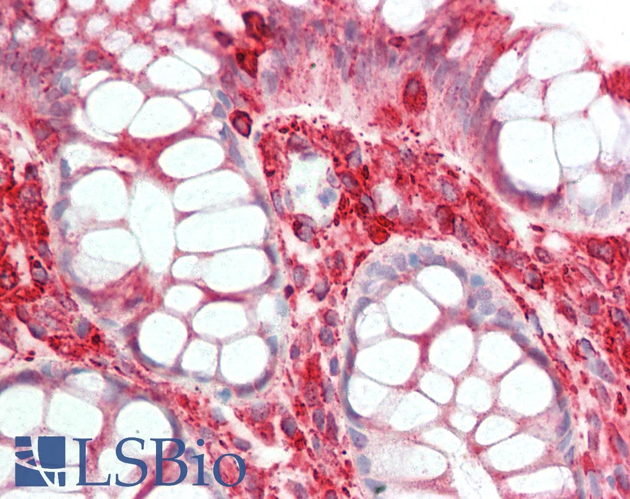 IHC-plus™ TUBA1B / Tubulin Alpha 1B Antibody (C-Terminus, clone 17H11.F10)