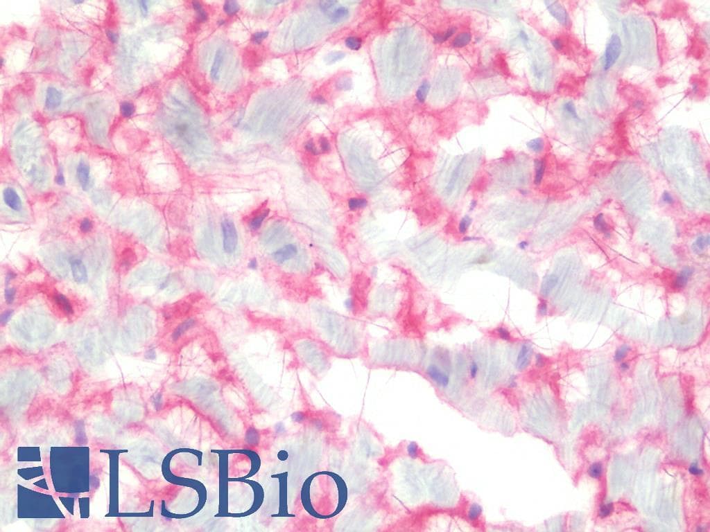 IHC-plus™ HSPG2 / Perlecan Antibody (clone A7L6)