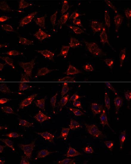 SCGB3A2 Antibody