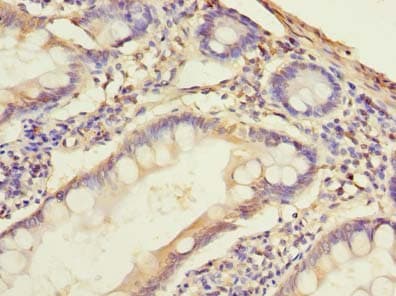 Polyclonal Rabbit anti-Human SLC38A2 / SNAT2 Antibody (aa1-76, IHC, WB)