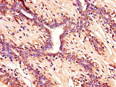 p16INK4a / CDKN2A Antibody