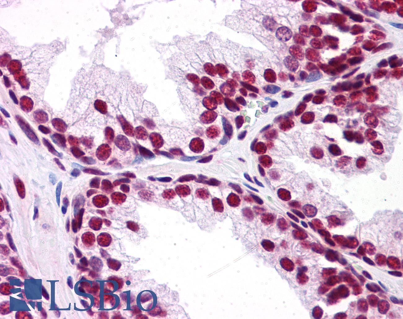 IHC-plus™ SAE2 / UBA2 Antibody