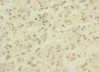 ADGRB1 / BAI1 Antibody (aa60-350)