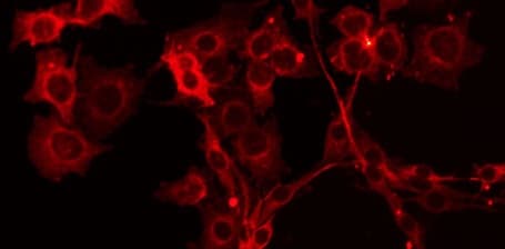 ZADH2 Antibody