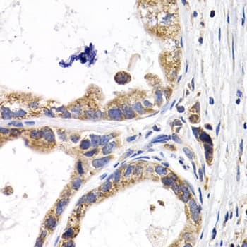Polyclonal Rabbit anti-Human FABP3 / H-FABP Antibody (IHC, IF, WB)