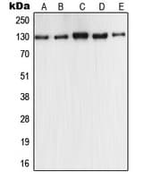 Polyclonal Rabbit anti-Human NOS2 / iNOS Antibody (C-Terminus, IHC, IF, WB)