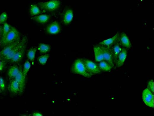 Polyclonal Rabbit anti-Human RPL4 / Ribosomal Protein L4 Antibody (IHC, IF, WB)
