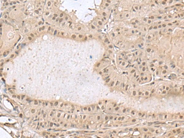 PCNA-Associated Factor Antibody