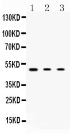 PRKAR1A Antibody