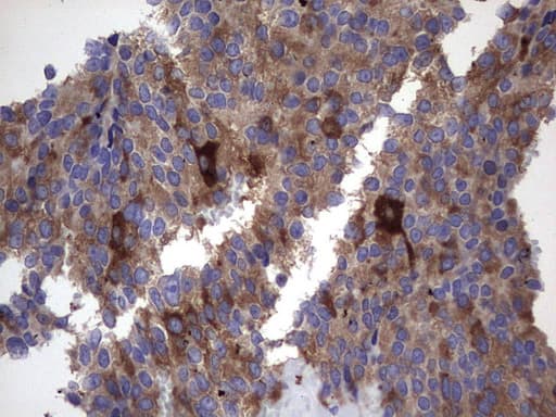Monoclonal Mouse anti-Human MAP1LC3A / LC3A Antibody (clone OTI10H6, IHC, WB)