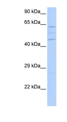 VPS37A Antibody (N-Terminus)