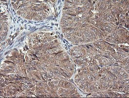 MAP2K1 / MKK1 / MEK1 Antibody (clone OTI2E8)
