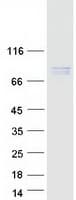 Human HEC1 / NDC80 Protein (Recombinant Myc-DDK (Flag))