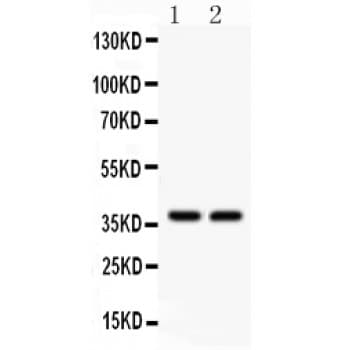 AHR Antibody (aa525-552)