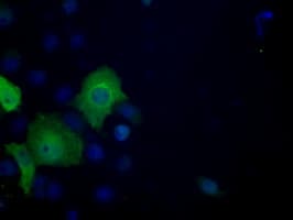 IHC-plus™ Monoclonal Mouse anti-Human ACLY / ATP Citrate Lyase Antibody (clone 3G8, IHC, IF, WB)