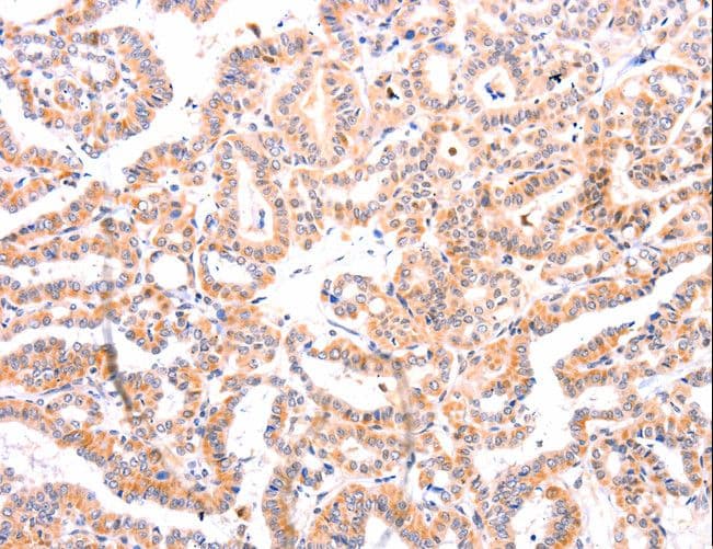 EFNA1 / Ephrin A1 Antibody