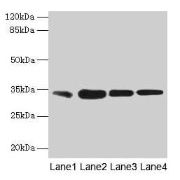 Polyclonal Rabbit anti-Human RAD23A / HHR23A Antibody (IHC, WB)