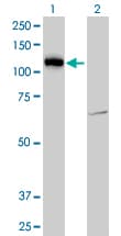 Monoclonal Mouse anti-Human LLGL2 Antibody (clone 4G2, WB)