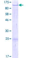 Human ZNF668 Protein (Recombinant GST)