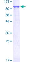Human GFPT1 / GFAT Protein (Recombinant GST)