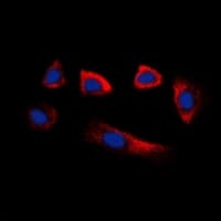 GLYCTK / Glycerate Kinase Antibody (Internal)