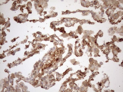 KRT16 / CK16 / Cytokeratin 16 Antibody (clone OTI1G1, Carrier-free)