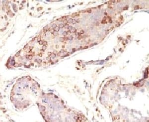Monoclonal Mouse anti-Human MAGEA1 / MAGE 1 Antibody (clone MAAZ2, IHC, IF)