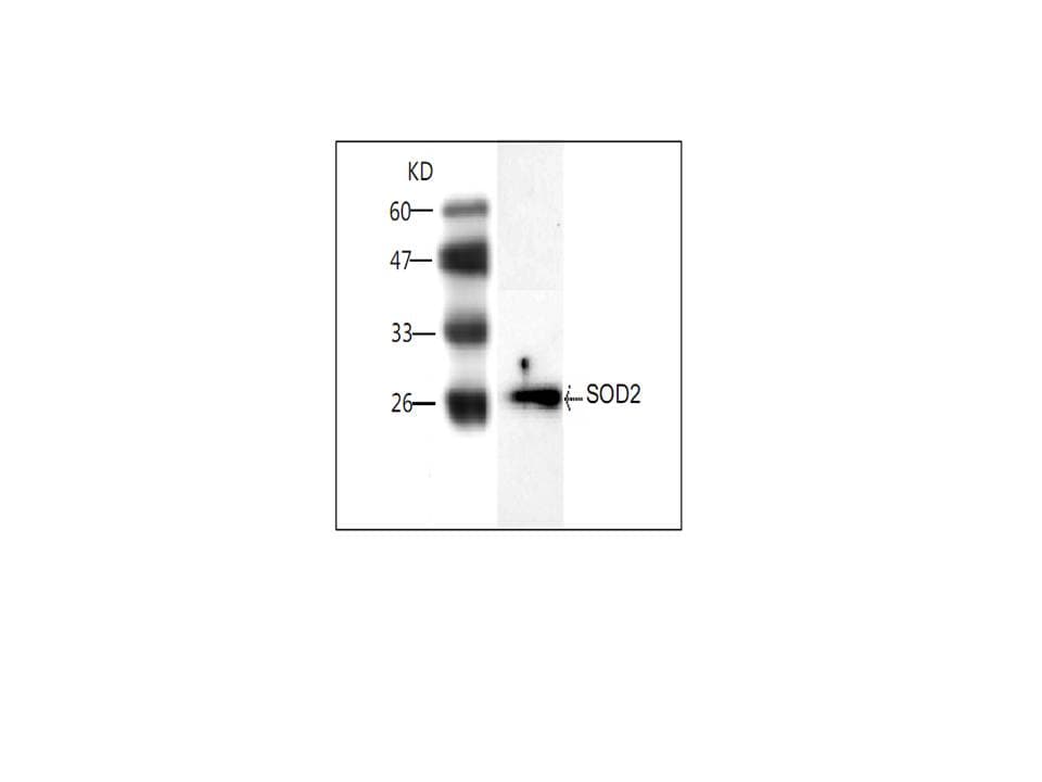 SOD2 / Mn SOD Antibody