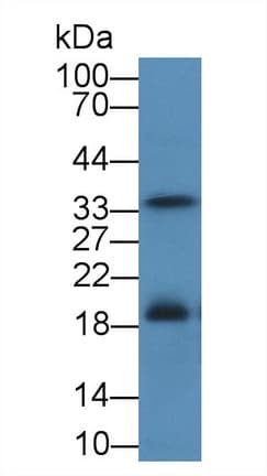 FASLG / Fas Ligand Antibody (aa102-280, PE)