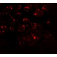 IHC-plus™ Polyclonal Rabbit anti-Human MTERF3 / MTERFD1 Antibody (IHC, IF, WB)