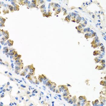 TICAM1 / TRIF Antibody