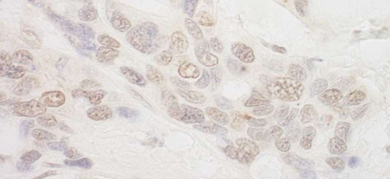 AQR Antibody (aa1435-1485)