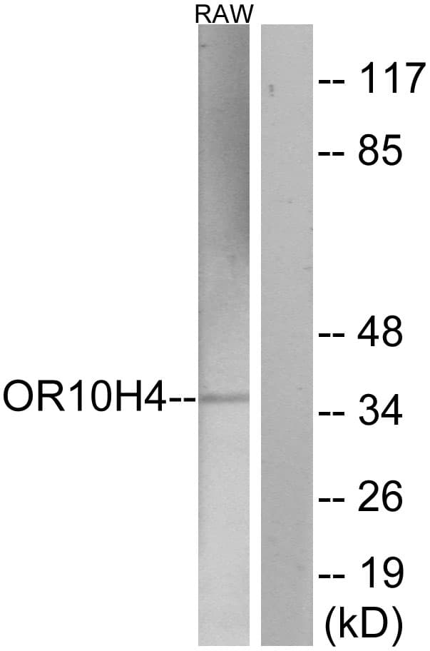 OR10H4 Antibody (aa161-210)
