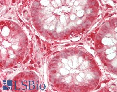 IHC-plus™ PSMA3 Antibody