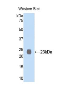 MME / CD10 Antibody (aa565-750, APC)