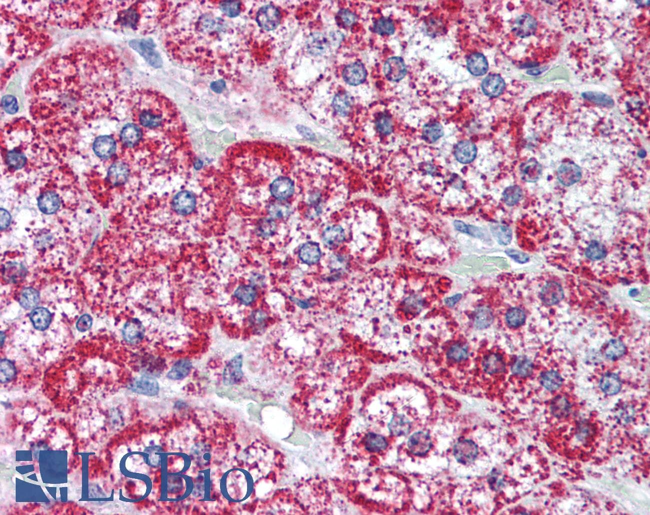 IHC-plus™ Polyclonal Rabbit anti-Human HSPD1 / HSP60 Antibody (aa350-400, IHC, WB)