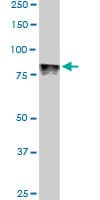 Monoclonal Mouse anti-Human DYRK / DYRK1A Antibody (clone 7D10, WB)