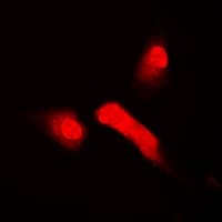 Polyclonal Rabbit anti-Human FBXW11 Antibody (IHC, IF, WB)