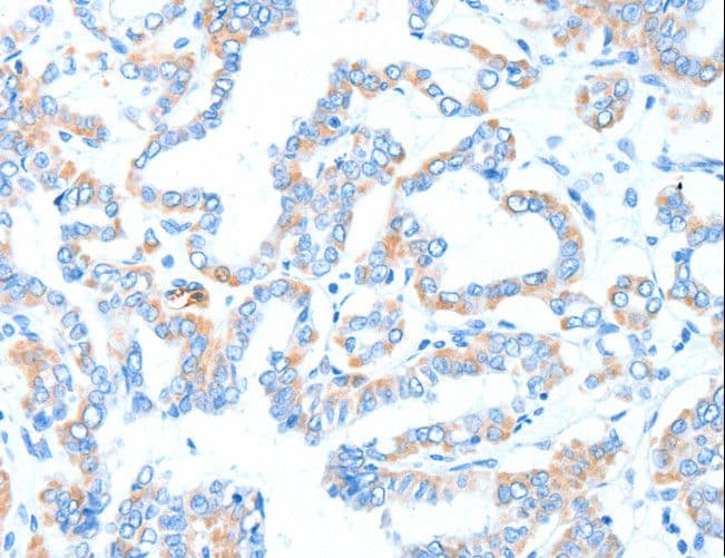 GPT / Alanine Transaminase Antibody