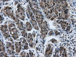 Heat Shock Protein 70 / HSPA1A Antibody (clone OTI1H5)