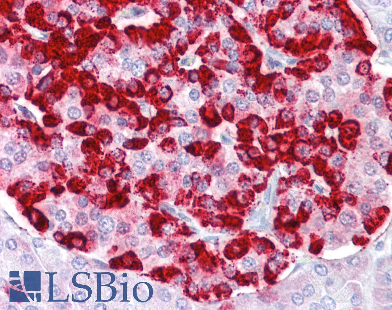 IHC-plus™ Polyclonal Rabbit anti-Human CXXC5 Antibody (IHC, IF, WB)