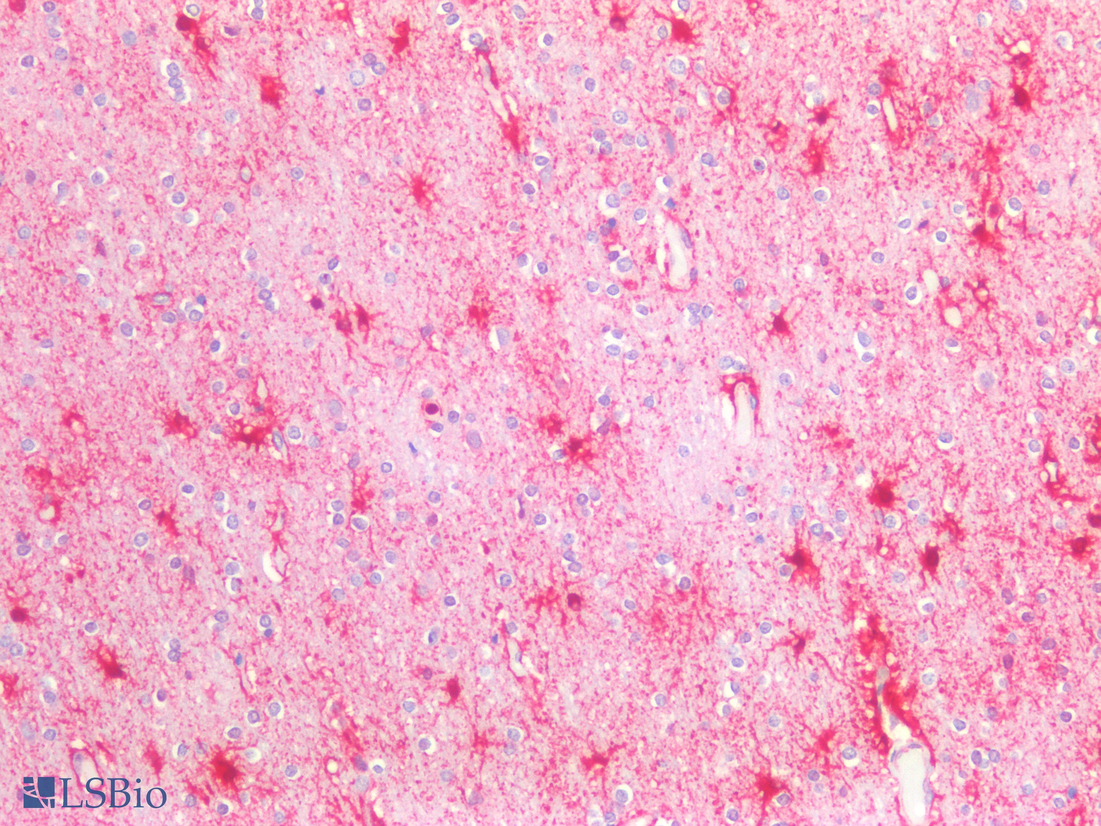 PathPlus™ IL6ST / CD130 / gp130 Antibody