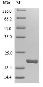 Human NUDT1 / MTH1 Protein (Recombinant)