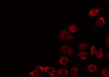 Polyclonal Rabbit anti-Human F2RL3 / PAR4 Antibody (IF, WB)