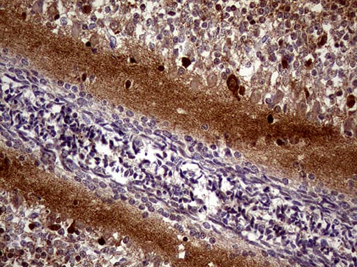 MAPT / Tau Antibody (aa623-758, clone OTI13B5)
